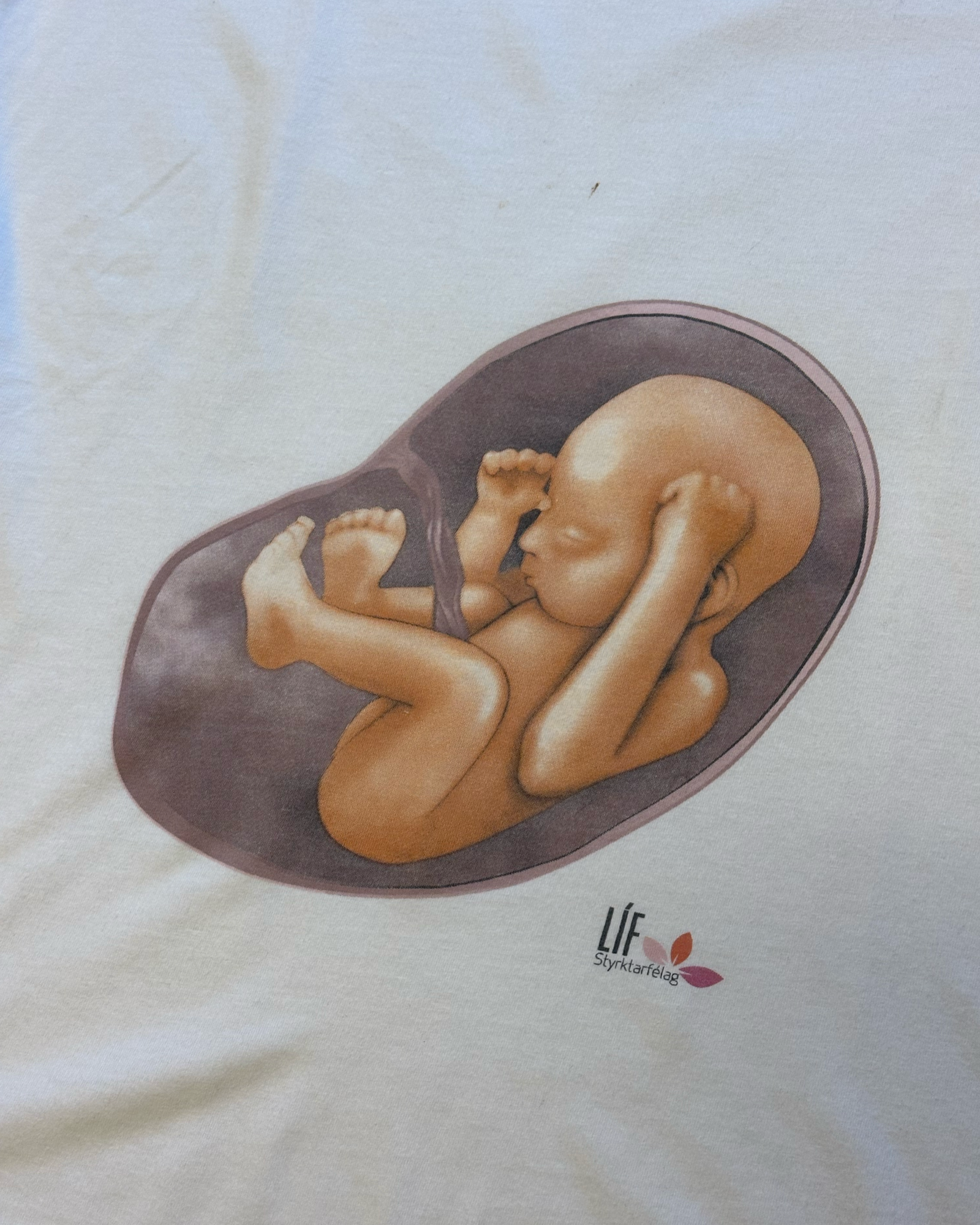 Líf styrktarfélag M